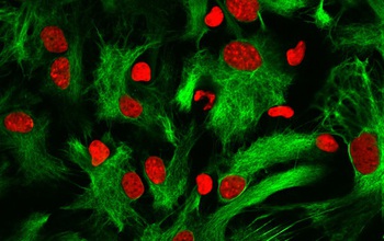 Image astrocytes from a rat brain